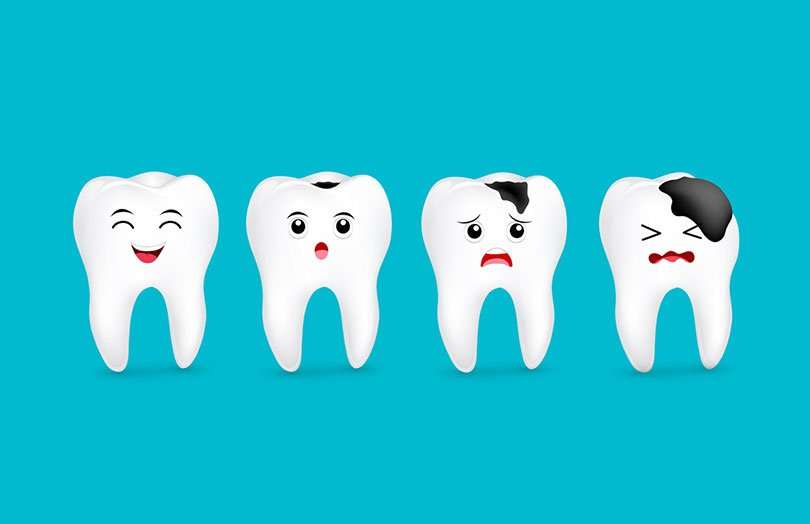 علل پوسیدگی دندان