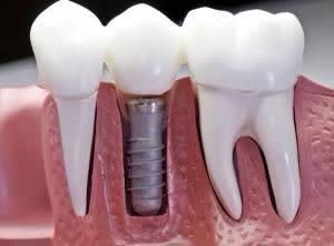 دندانپزشکی ولنجک